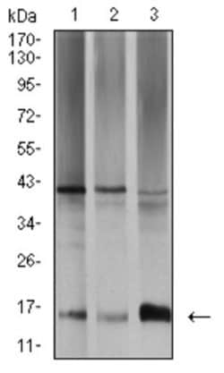 Toxoplasma gondii SAG2 Antibody (1D12B8) - BSA Free, Novus Biologicals